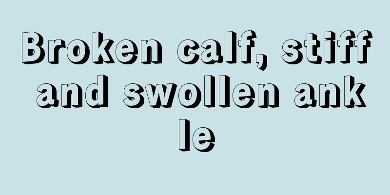 Broken calf, stiff and swollen ankle