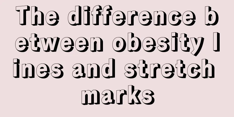 The difference between obesity lines and stretch marks