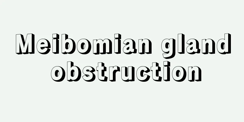 Meibomian gland obstruction