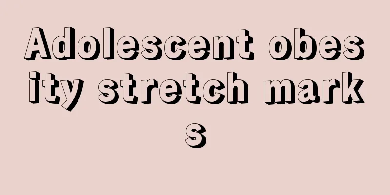Adolescent obesity stretch marks