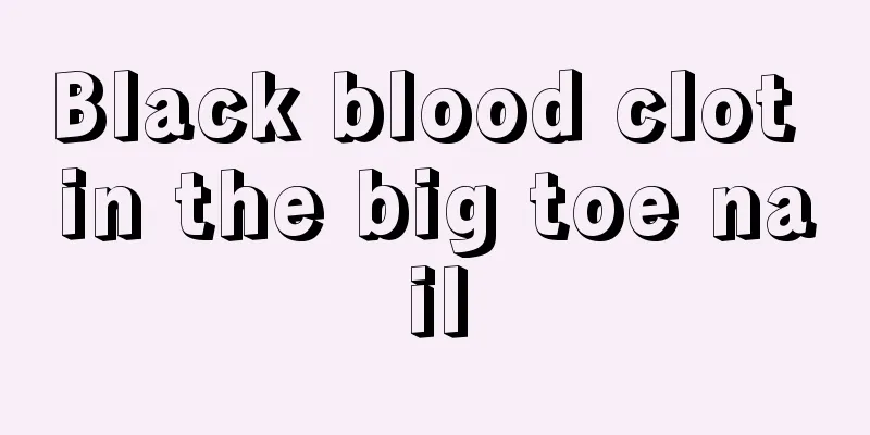 Black blood clot in the big toe nail