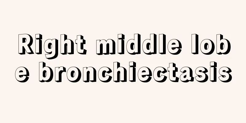 Right middle lobe bronchiectasis