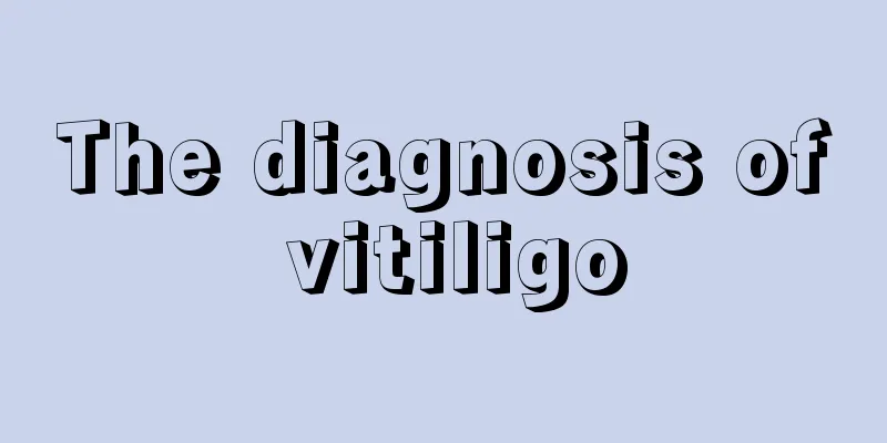 The diagnosis of vitiligo