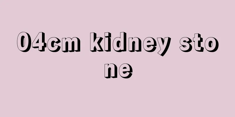 04cm kidney stone