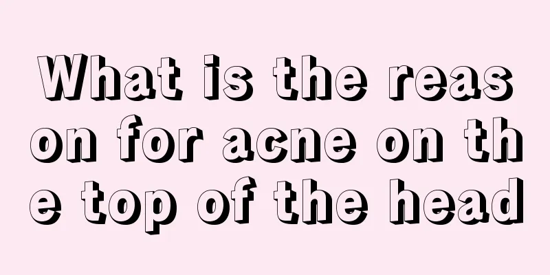 What is the reason for acne on the top of the head