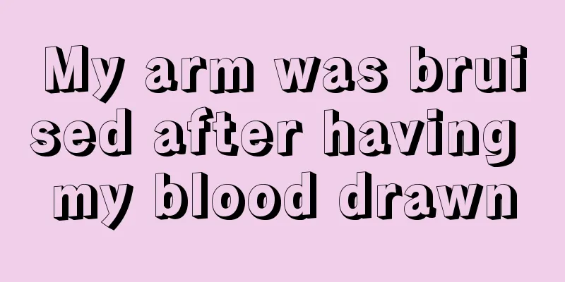 My arm was bruised after having my blood drawn