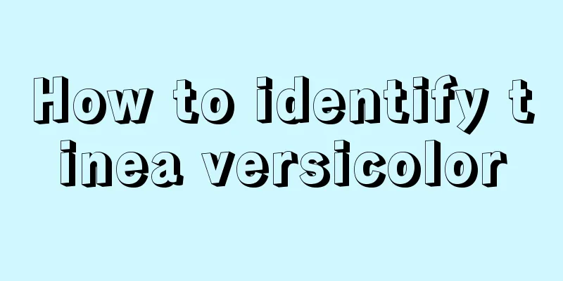 How to identify tinea versicolor