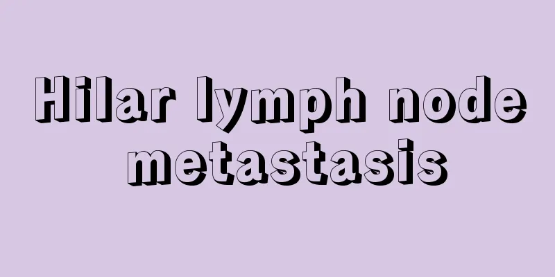 Hilar lymph node metastasis