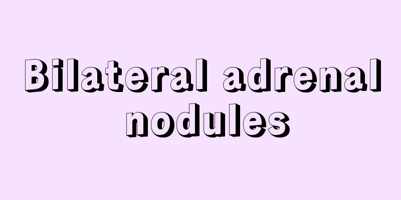 Bilateral adrenal nodules