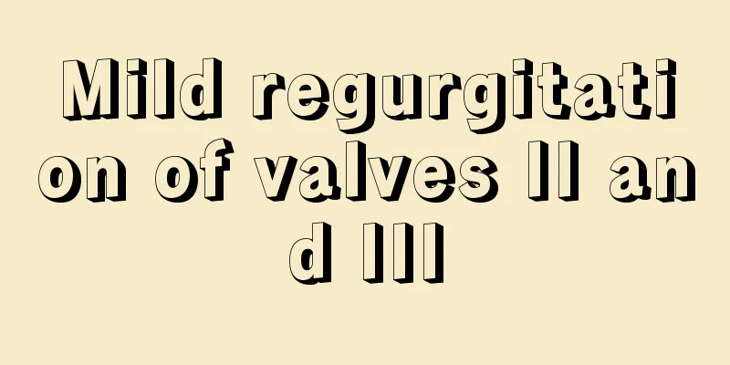 Mild regurgitation of valves II and III