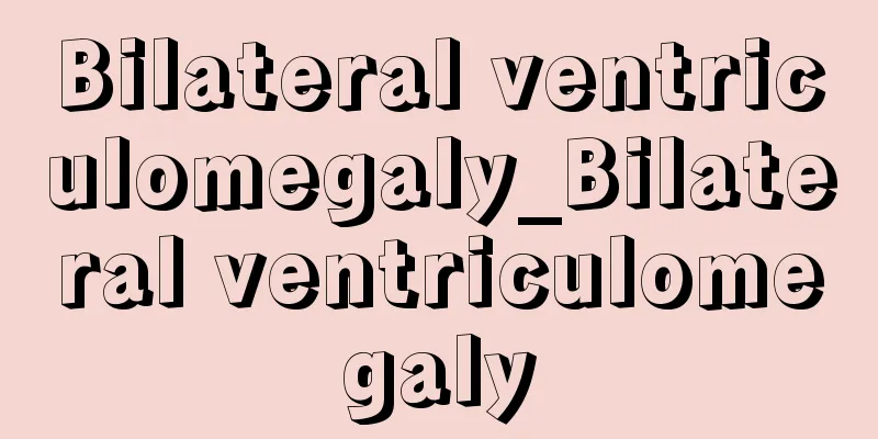 Bilateral ventriculomegaly_Bilateral ventriculomegaly