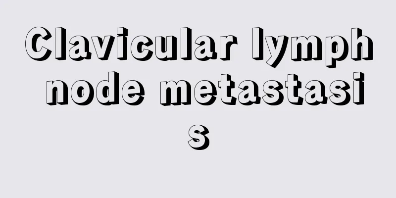 Clavicular lymph node metastasis