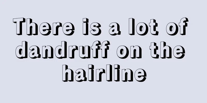 There is a lot of dandruff on the hairline