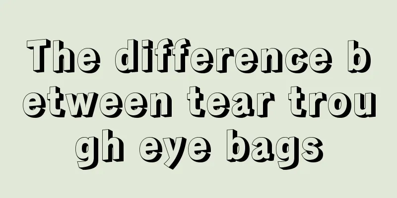 The difference between tear trough eye bags