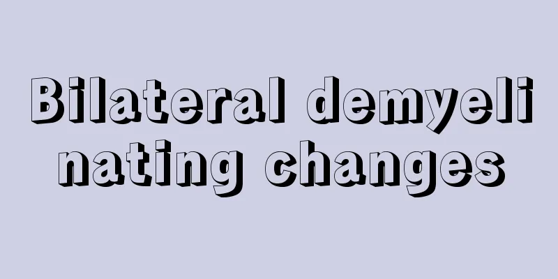 Bilateral demyelinating changes