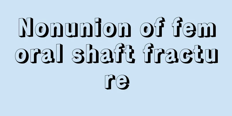 Nonunion of femoral shaft fracture