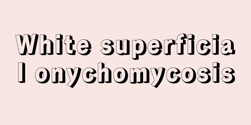 White superficial onychomycosis