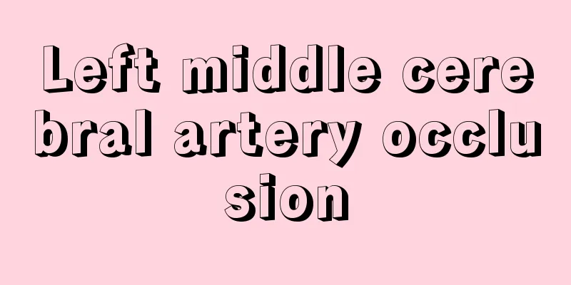 Left middle cerebral artery occlusion