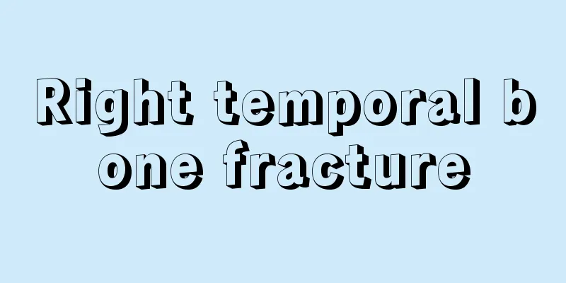 Right temporal bone fracture