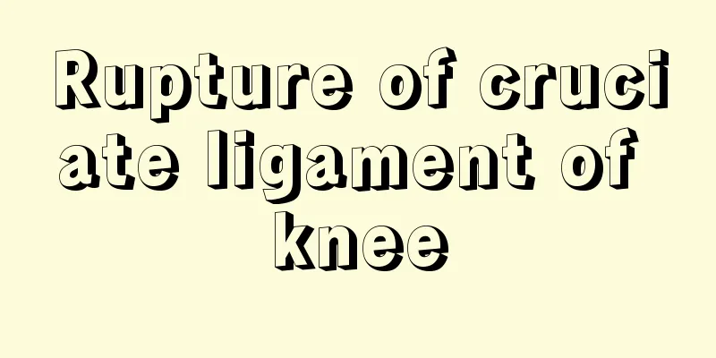 Rupture of cruciate ligament of knee