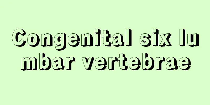 Congenital six lumbar vertebrae