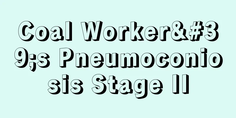 Coal Worker's Pneumoconiosis Stage II
