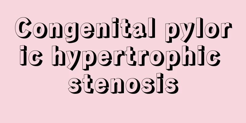 Congenital pyloric hypertrophic stenosis