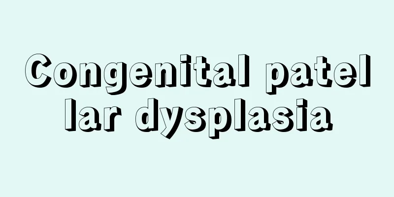 Congenital patellar dysplasia