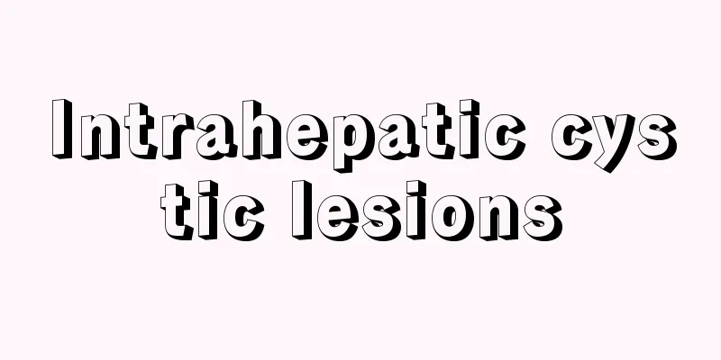 Intrahepatic cystic lesions