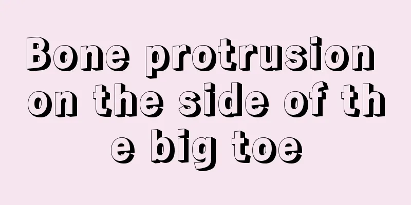 Bone protrusion on the side of the big toe