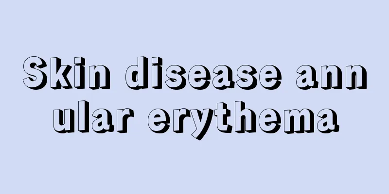 Skin disease annular erythema