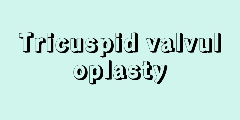Tricuspid valvuloplasty