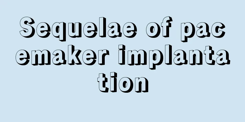 Sequelae of pacemaker implantation