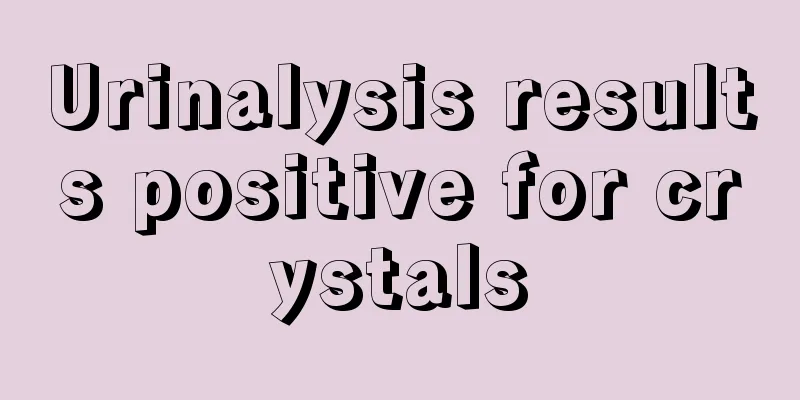 Urinalysis results positive for crystals