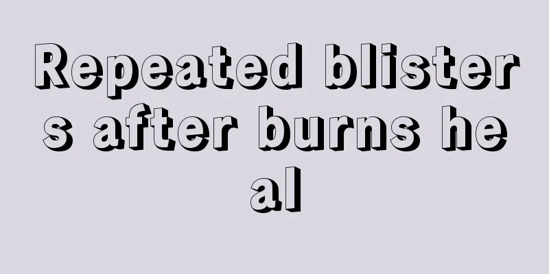 Repeated blisters after burns heal