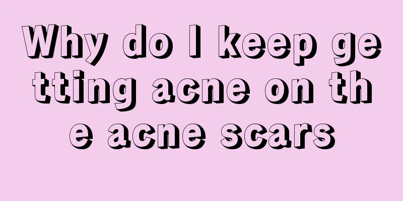 Why do I keep getting acne on the acne scars