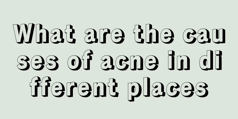 What are the causes of acne in different places