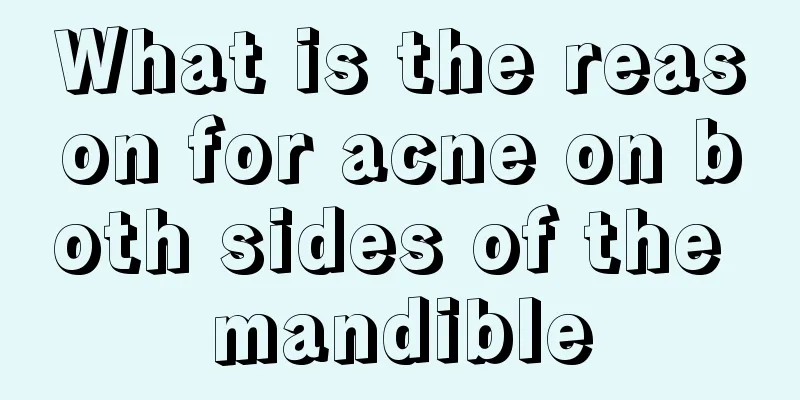 What is the reason for acne on both sides of the mandible
