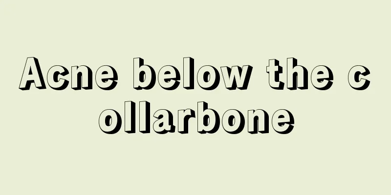 Acne below the collarbone