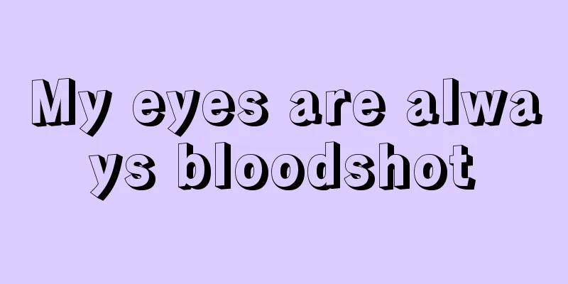 My eyes are always bloodshot