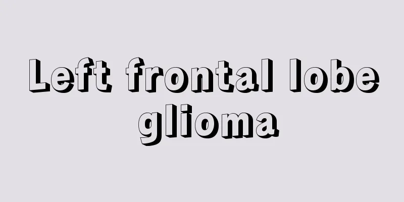 Left frontal lobe glioma