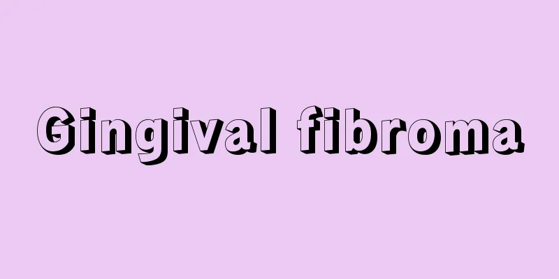 Gingival fibroma