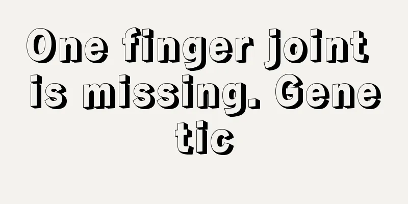 One finger joint is missing. Genetic