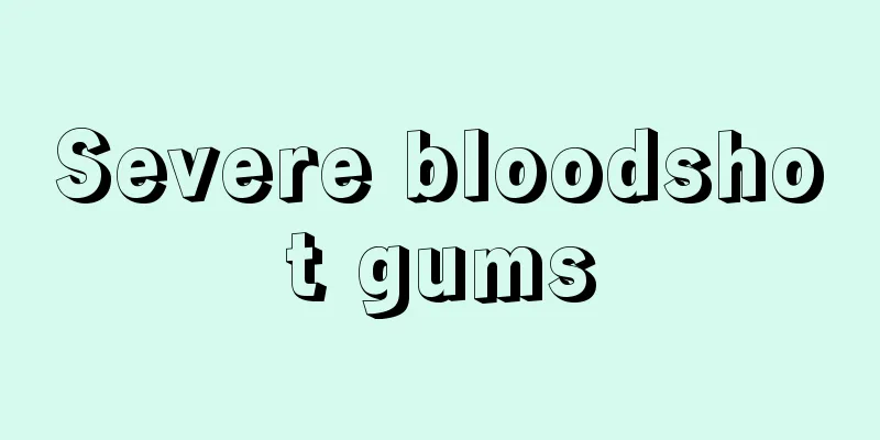 Severe bloodshot gums