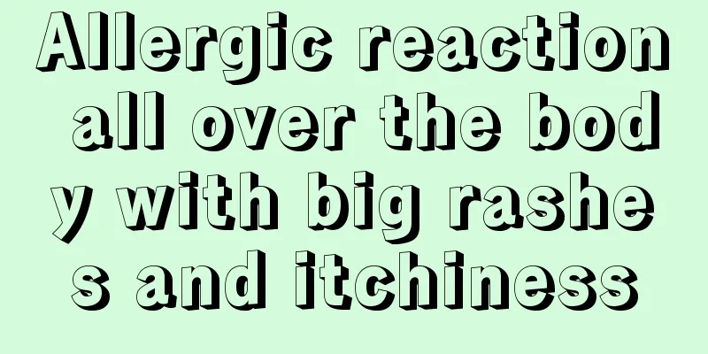 Allergic reaction all over the body with big rashes and itchiness