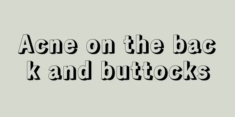 Acne on the back and buttocks