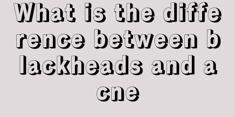 What is the difference between blackheads and acne
