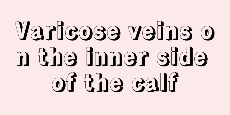 Varicose veins on the inner side of the calf