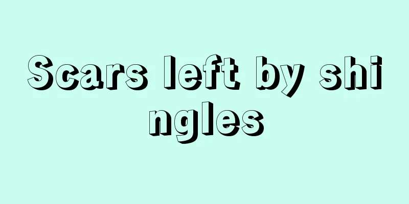 Scars left by shingles