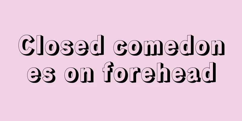 Closed comedones on forehead